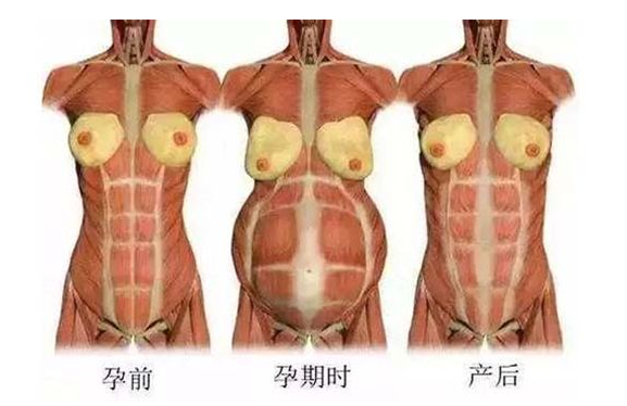 產(chǎn)后媽媽骨盆修復(fù)――帶你回到完美身材！
